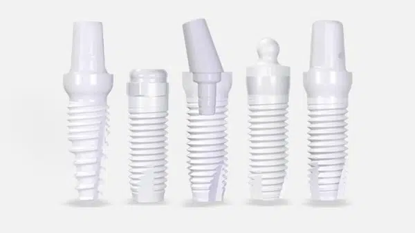 Ceramic Implants — Natural Tooth Crafted Without Metal Components at Dr. Jay Family Dental