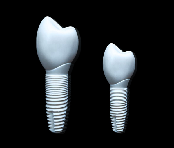 What Are The Benefits Of Zirconia Implants? at Dr. Jay Family Dental