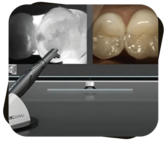 CariVu at Dr. Jay Family Dental