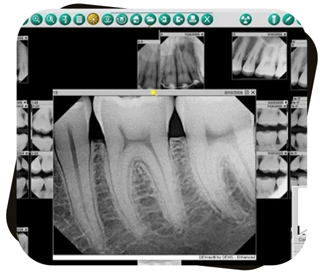 Digital X-ray at Dr. Jay Family Dental